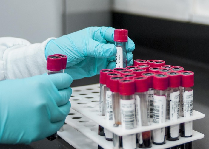 De PID Biobank: jouw toestemming voor onderzoek